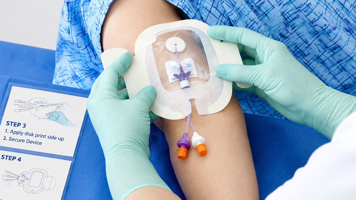 CLABSI-diagnosis تشخیص عفونت جریان خون مرتبط با کاتتر ورید مرکزی (CLABSI)