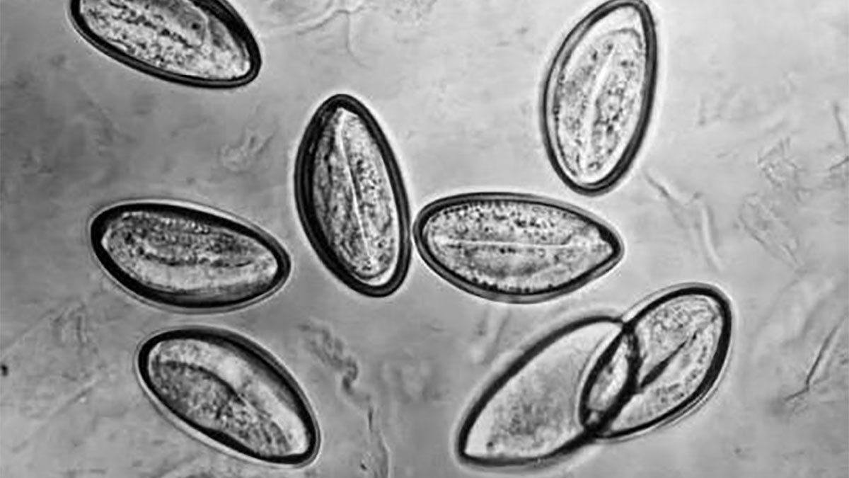 Enterobius vermicularis