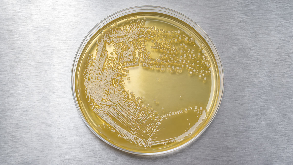 quality-control-testing شناسایی Pseudomonas aeruginosa در آزمون میکروبی محصولات آرایشی