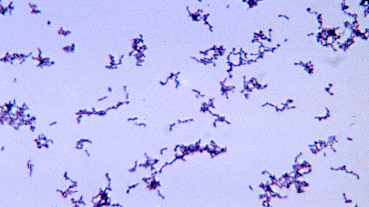 مورفولوژی باکتری Cutibacterium acnes