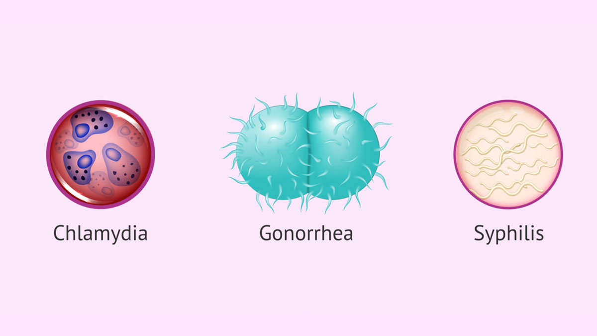 causes-of-salpingitis علت اصلی سالپنژیت