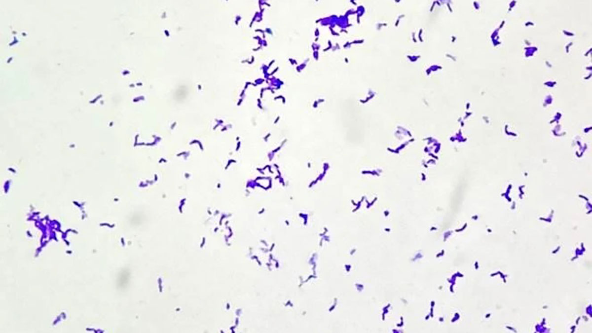 بررسی میکروسکوپی C. acnes