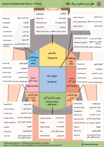 علل درد شکم در یک نگاه